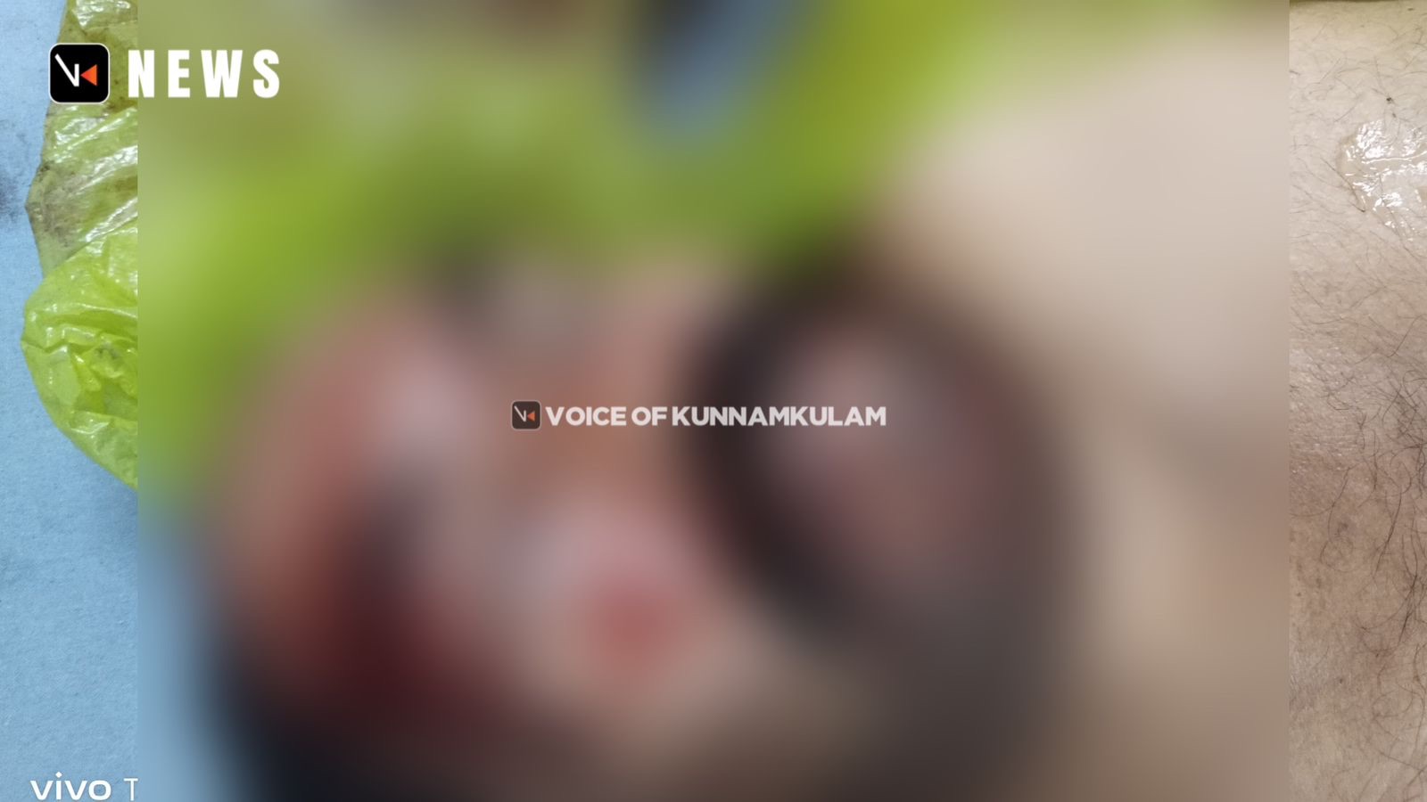 കുന്നംകുളത്ത്‌ വീണ്ടും വാഹനാപകടം : കിഴൂർ സ്വദേശി മരിച്ചു